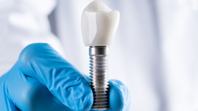 Implantati